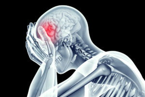 Concussion