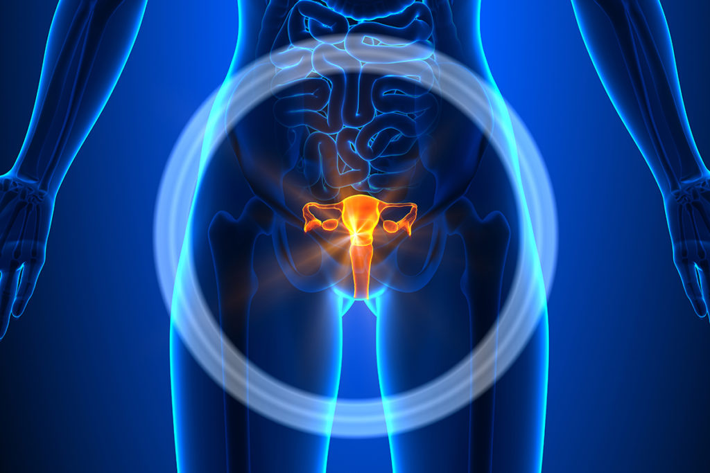 a medical test scan of a woman's uterus used to explain the need for Eschariotic treatment.