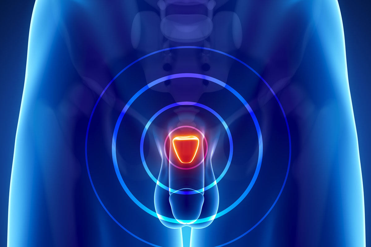 Pomegranate Extract Slows PSA Rise in Recurrent Prostate Cancer Patients