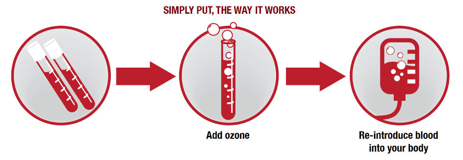Ozone-2